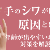 手のシワが目立つ原因とは？年齢が出やすい理由と対策を解説