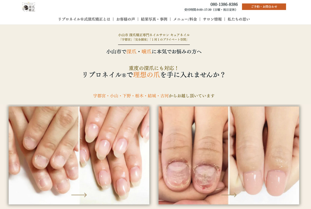 深爪矯正専門ネイルサロン キュアネイル（Qa♡Nail）