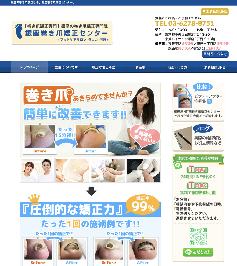 銀座巻き爪矯正センター