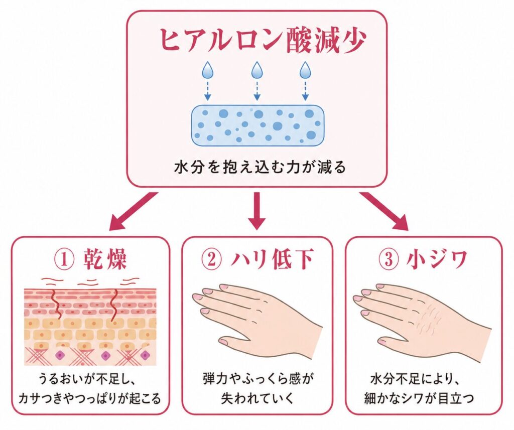 ヒアルロン酸減少によって乾燥・ハリ低下・小ジワが目立つ流れを示す図