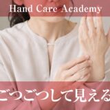 手がごつごつして見える理由