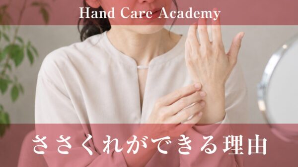 ささくれができる理由｜乾燥・摩擦・水仕事・バリアを解説