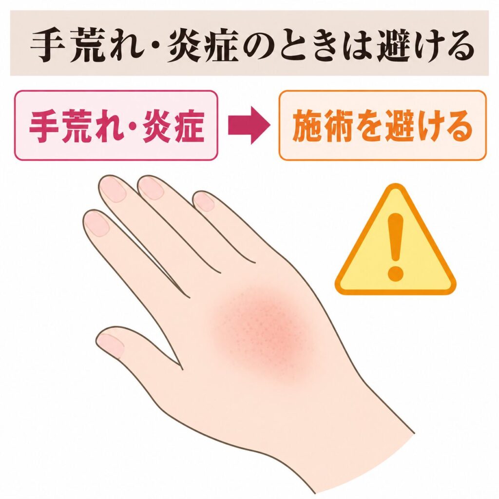 パラフィンパックを受ける前の注意点の図