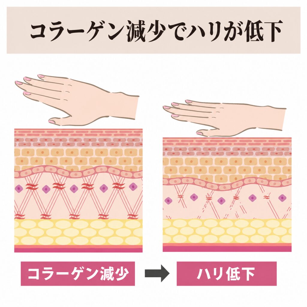 コラーゲン減少からハリ低下につながる図