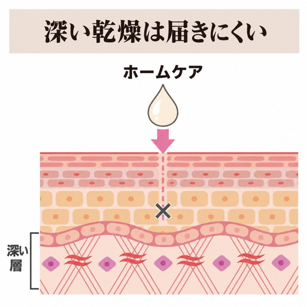 ホームケアだけでは続きにくい深い乾燥の図